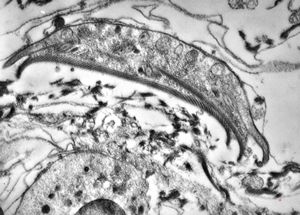 Giardia (lamblia) intestinalis Giardia (lamblia) intestinalis